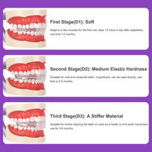 Load image into Gallery viewer, Dental Aligner Braces- Orthodontic Teeth Alignment Brace Trainer