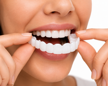 Load image into Gallery viewer, Snap-On Smile Veneers for Men & Women – Instant Natural White Smile