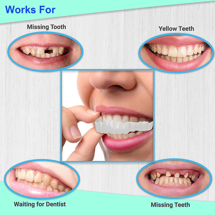 Smile Veneers - Adjustable Snap On Dentures - Doctors Recommended