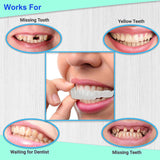 Smile Veneers - Adjustable Snap On Dentures - Doctors Recommended