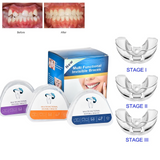 Dental Aligner Braces- Orthodontic Teeth Alignment Brace Trainer