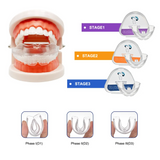 Dental Aligner Braces- Orthodontic Teeth Alignment Brace Trainer