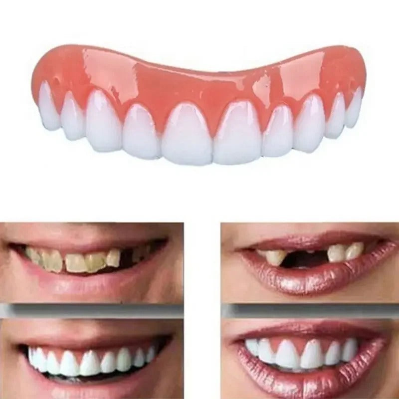 Snap On Dentures Kit - Perfect Smile Veneers (Upper & Lower)