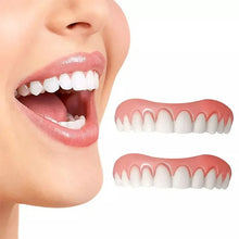 Load image into Gallery viewer, Snap On Dentures Kit - Perfect Smile Veneers (Upper &amp; Lower)
