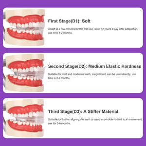 Dental Aligner Braces- Orthodontic Teeth Alignment Brace Trainer