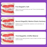 Dental Aligner Braces- Orthodontic Teeth Alignment Brace Trainer