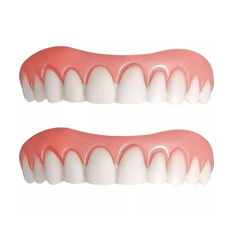 Snap On Dentures Kit - Perfect Smile Veneers (Upper & Lower)