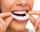 Snap-On Smile Veneers for Men & Women – Instant Natural White Smile