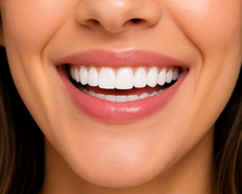 Load image into Gallery viewer, Snap-On Smile Veneers for Men &amp; Women – Instant Natural White Smile
