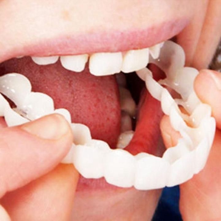 Adjustable Snap On Dentures - Smile Veneers - Doctors Recommended
