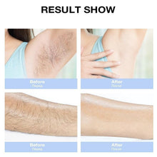 Load image into Gallery viewer, Professional Laser Hair Remover Machine
