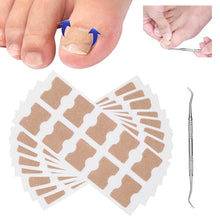 Load image into Gallery viewer, Ingrown Toenail Corrector Patches
