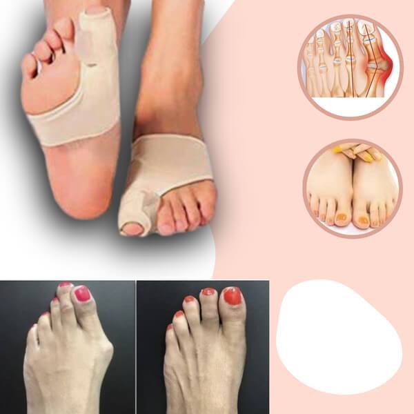 FeelGreat Orthopedic Toe Bunion Corrector - Doctors Recommended