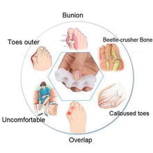Load image into Gallery viewer, BESTWALK Orthopedic Toe Bunion Corrector
